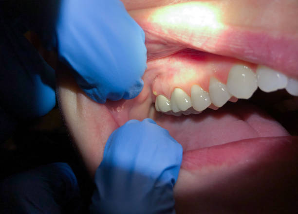 Best After-Hours Emergency Dentist in Perkins, OK