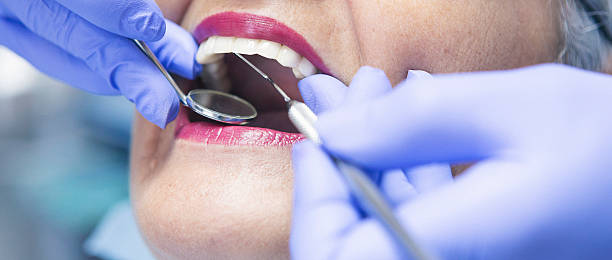 Best Emergency Tooth Extraction in Perkins, OK